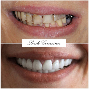 Slider image (6) FMS Dental Hospital - Kukatpally